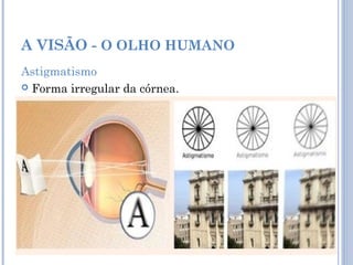 A VISÃO - O OLHO HUMANO 
Astigmatismo 
 Forma irregular da córnea. 
 