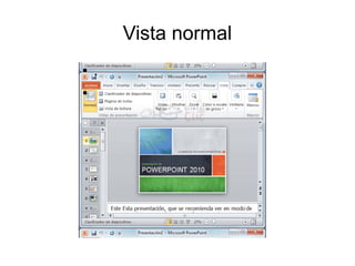 Vista normal
● .
●