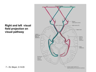 Right and left  visual field projection on visual pathway 7 – DL Mayer, 3-14-05 