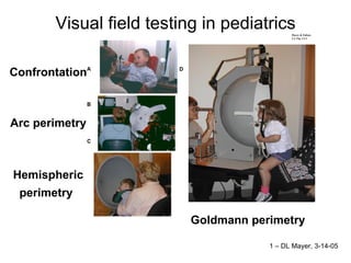 Visual field testing in pediatrics Confrontation  Arc perimetry  Hemispheric perimetry   Goldmann perimetry  1 – DL Mayer, 3-14-05 