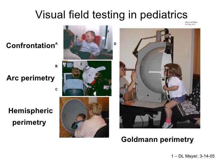 visual-field-testing-in-pediatrics
