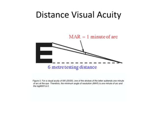 Distance Visual Acuity
 