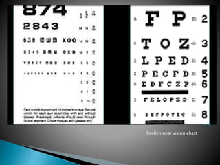 Snellen near vision chart
 