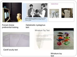 Preferential Test Visual acuity | PPTX