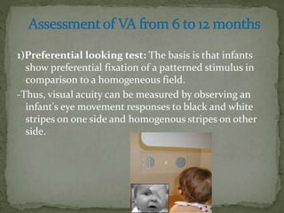 Preferential Test Visual acuity | PPTX
