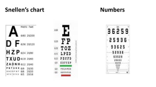 Snellen’s chart Numbers
 