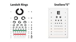 Landolt Rings Snellens“E”
 