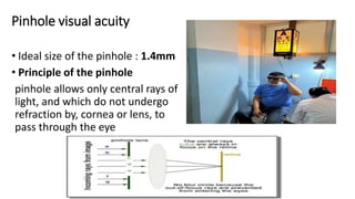 Pinhole visual acuity
• Ideal size of the pinhole : 1.4mm
• Principle of the pinhole
pinhole allows only central rays of
light, and which do not undergo
refraction by, cornea or lens, to
pass through the eye
 