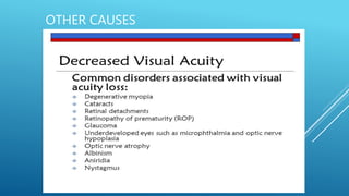 Visual acuity special Senses Physiology | PPTX