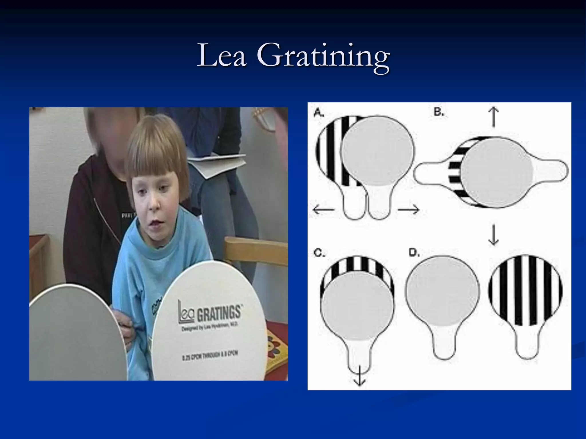 Visual acuity assessment in different group of age | PPTX