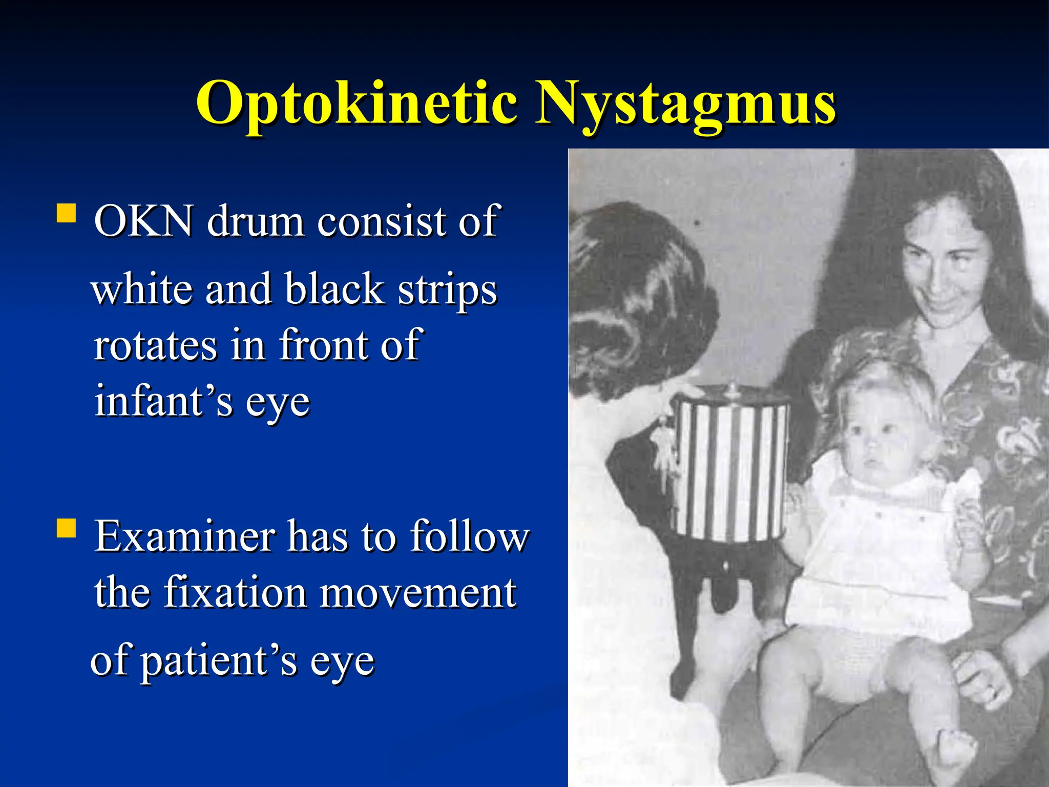 Optokinetic Nystagmus
Optokinetic Nystagmus
 OKN drum consist of
OKN drum consist of
white and black strips
white and black strips
rotates in front of
rotates in front of
infant’s eye
infant’s eye
 Examiner has to follow
Examiner has to follow
the fixation movement
the fixation movement
of patient’s eye
of patient’s eye
 