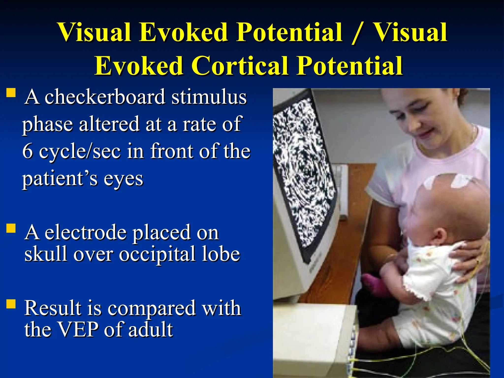 Visual Evoked Potential
Visual Evoked Potential /
/ Visual
Visual
Evoked Cortical Potential
Evoked Cortical Potential
 A checkerboard stimulus
A checkerboard stimulus
phase altered at a rate of
phase altered at a rate of
6 cycle/sec in front of the
6 cycle/sec in front of the
patient’s eyes
patient’s eyes
 A electrode placed on
A electrode placed on
skull over occipital lobe
skull over occipital lobe
 Result is compared with
Result is compared with
the VEP of adult
the VEP of adult
 