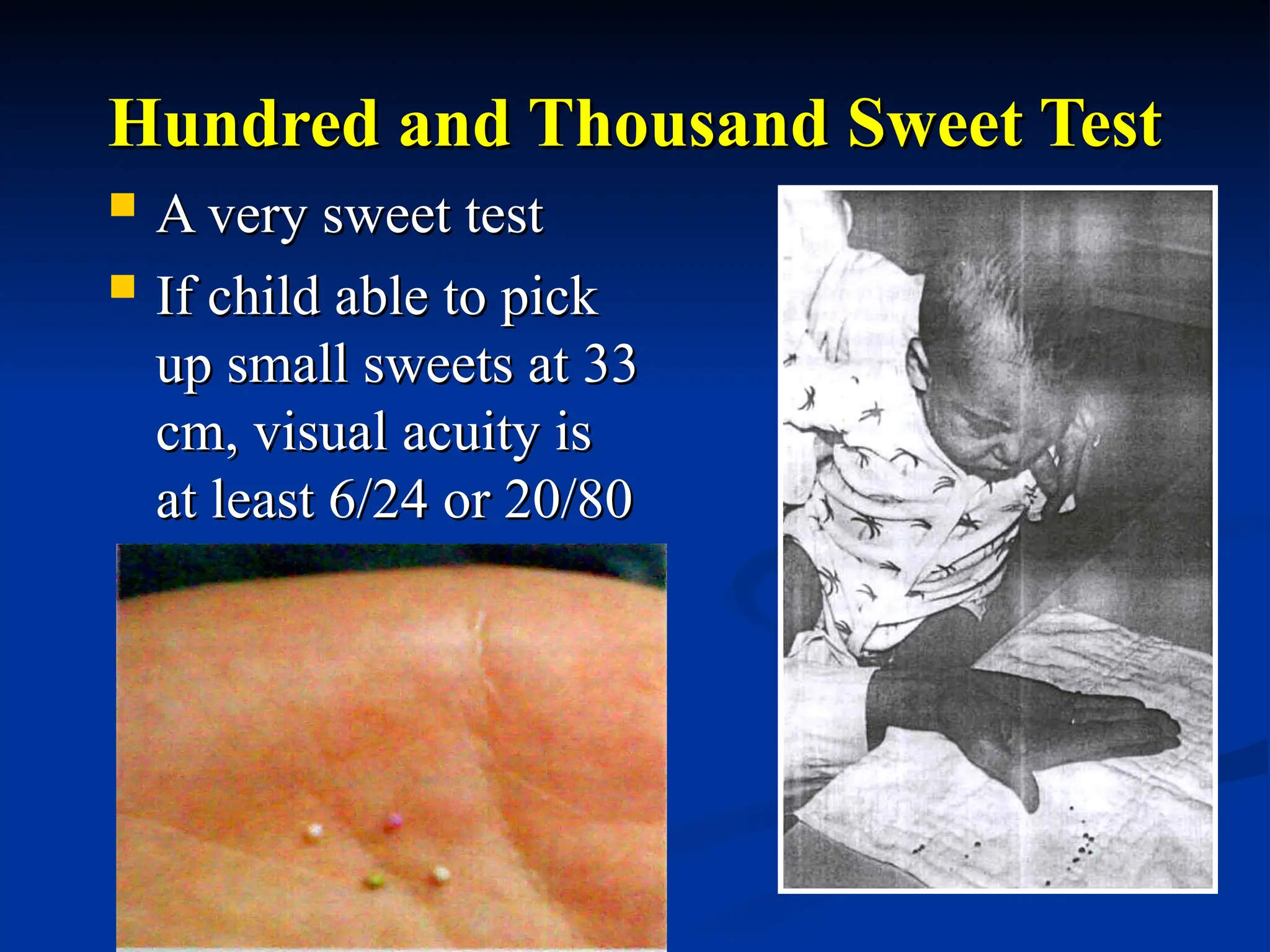 Hundred and Thousand Sweet Test
Hundred and Thousand Sweet Test
 A very sweet test
A very sweet test
 If child able to pick
If child able to pick
up small sweets at 33
up small sweets at 33
cm, visual acuity is
cm, visual acuity is
at least 6/24 or 20/80
at least 6/24 or 20/80
 