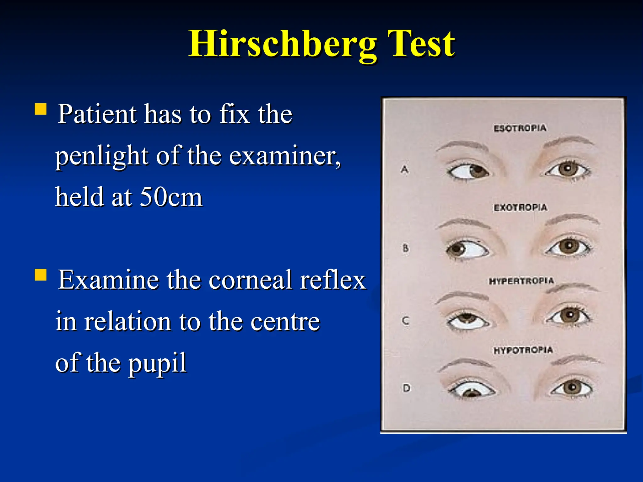 Hirschberg Test
Hirschberg Test
 Patient has to fix the
Patient has to fix the
penlight of the examiner,
penlight of the examiner,
held at 50cm
held at 50cm
 Examine the corneal reflex
Examine the corneal reflex
in relation to the centre
in relation to the centre
of the pupil
of the pupil
 