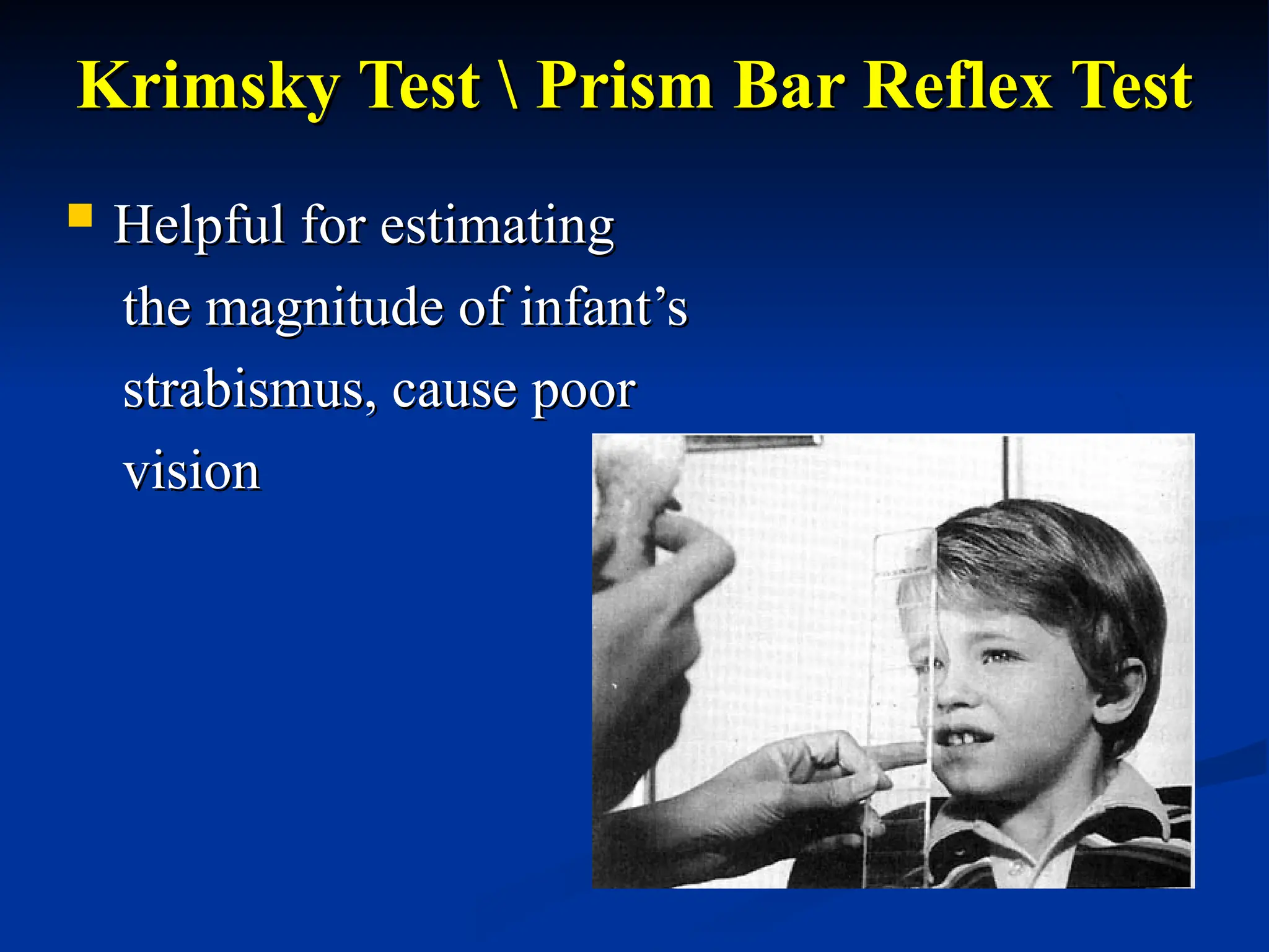 Krimsky Test  Prism Bar Reflex Test
Krimsky Test  Prism Bar Reflex Test
 Helpful for estimating
Helpful for estimating
the magnitude of infant’s
the magnitude of infant’s
strabismus, cause poor
strabismus, cause poor
vision
vision
 