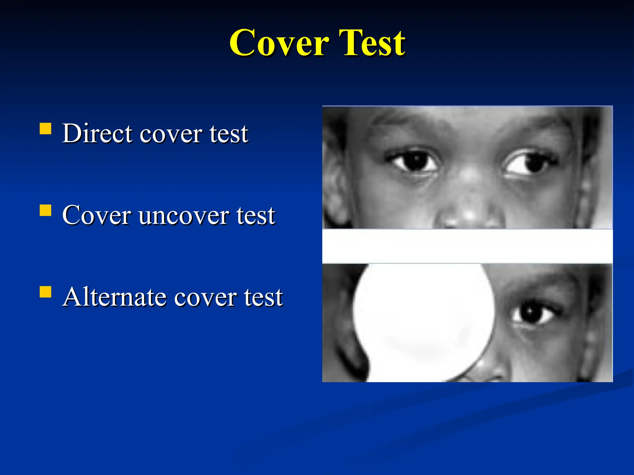 Cover Test
Cover Test
 Direct cover test
Direct cover test
 Cover uncover test
Cover uncover test
 Alternate cover test
Alternate cover test
 