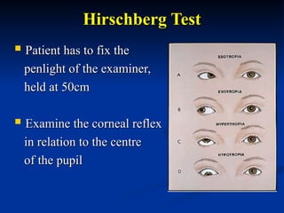 Hirschberg Test Normal Visual_Acuity_Assessment_in_Children.ppt