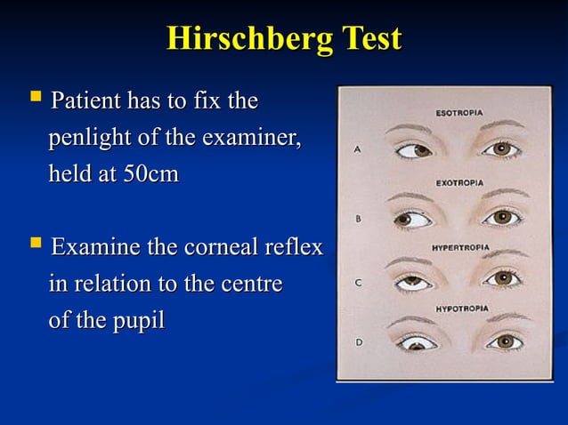 Fixation Preference Testing Visual_Acuity_Assessment_in_Children.ppt