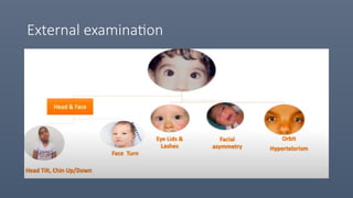 Comprehensive Visual Acuity Assessment and Development in Children | PPTX