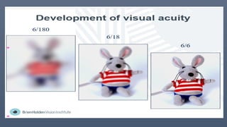 Comprehensive Visual Acuity Assessment and Development in Children | PPTX