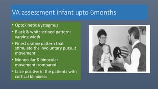 Comprehensive Visual Acuity Assessment and Development in Children | PPTX