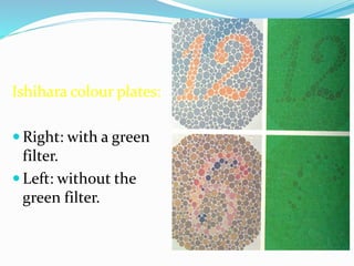 Ishihara colour plates:
 Right: with a green
filter.
 Left: without the
green filter.
 