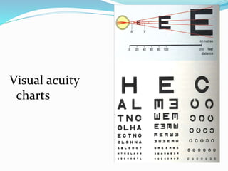 Visual acuity
charts
 