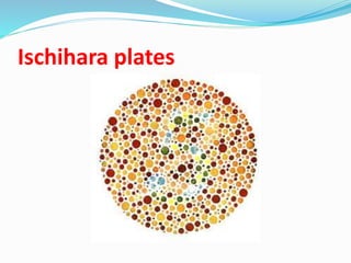 Ischihara plates
 