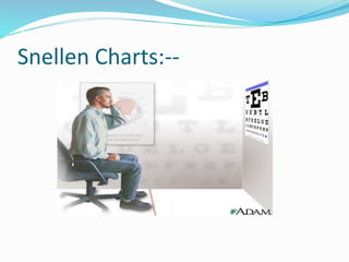Snellen Charts:--
 