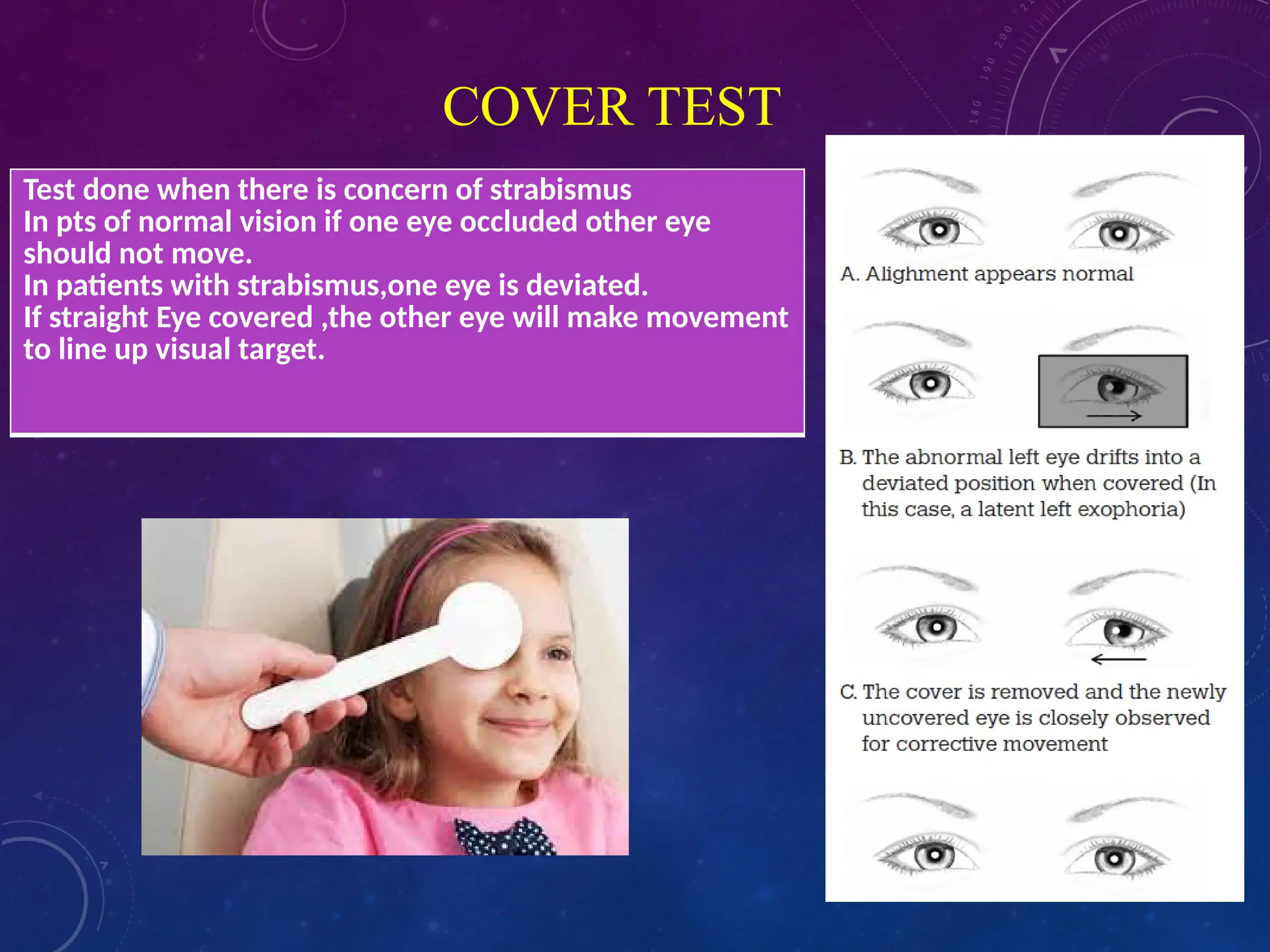 COVER TEST
Test done when there is concern of strabismus
In pts of normal vision if one eye occluded other eye
should not move.
In patients with strabismus,one eye is deviated.
If straight Eye covered ,the other eye will make movement
to line up visual target.
 