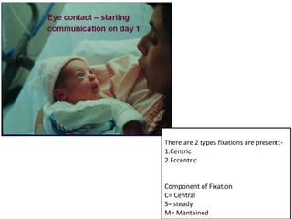 There are 2 types fixations are present:-
1.Centric
2.Eccentric
Component of Fixation
C= Central
S= steady
M= Mantained
 