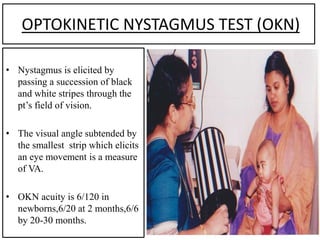 OPTOKINETIC NYSTAGMUS TEST (OKN)
• Nystagmus is elicited by
passing a succession of black
and white stripes through the
pt’s field of vision.
• The visual angle subtended by
the smallest strip which elicits
an eye movement is a measure
of VA.
• OKN acuity is 6/120 in
newborns,6/20 at 2 months,6/6
by 20-30 months.
 