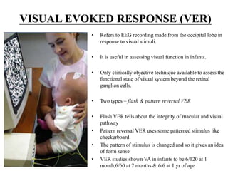 VISUAL EVOKED RESPONSE (VER)
• Refers to EEG recording made from the occipital lobe in
response to visual stimuli.
• It is useful in assessing visual function in infants.
• Only clinically objective technique available to assess the
functional state of visual system beyond the retinal
ganglion cells.
• Two types – flash & pattern reversal VER
• Flash VER tells about the integrity of macular and visual
pathway
• Pattern reversal VER uses some patterned stimulus like
checkerboard
• The pattern of stimulus is changed and so it gives an idea
of form sense
• VER studies shown VA in infants to be 6/120 at 1
month,6/60 at 2 months & 6/6 at 1 yr of age
 