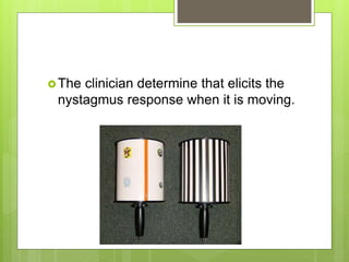The clinician determine that elicits the
nystagmus response when it is moving.
 