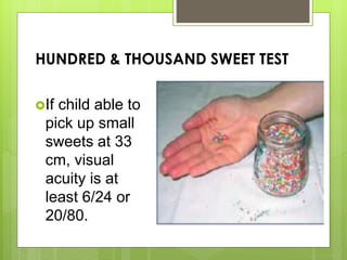 HUNDRED & THOUSAND SWEET TEST
If child able to
pick up small
sweets at 33
cm, visual
acuity is at
least 6/24 or
20/80.
 