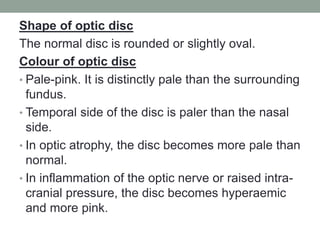Shape of optic disc
The normal disc is rounded or slightly oval.
Colour of optic disc
• Pale-pink. It is distinctly pale than the surrounding
fundus.
• Temporal side of the disc is paler than the nasal
side.
• In optic atrophy, the disc becomes more pale than
normal.
• In inflammation of the optic nerve or raised intra-
cranial pressure, the disc becomes hyperaemic
and more pink.
 