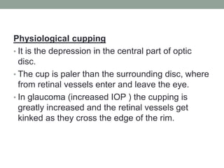 Physiological cupping
• It is the depression in the central part of optic
disc.
• The cup is paler than the surrounding disc, where
from retinal vessels enter and leave the eye.
• In glaucoma (increased IOP ) the cupping is
greatly increased and the retinal vessels get
kinked as they cross the edge of the rim.
 