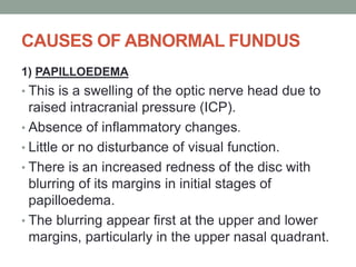 CAUSES OF ABNORMAL FUNDUS
1) PAPILLOEDEMA
• This is a swelling of the optic nerve head due to
raised intracranial pressure (ICP).
• Absence of inflammatory changes.
• Little or no disturbance of visual function.
• There is an increased redness of the disc with
blurring of its margins in initial stages of
papilloedema.
• The blurring appear first at the upper and lower
margins, particularly in the upper nasal quadrant.
 