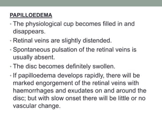 PAPILLOEDEMA
• The physiological cup becomes filled in and
disappears.
• Retinal veins are slightly distended.
• Spontaneous pulsation of the retinal veins is
usually absent.
• The disc becomes definitely swollen.
• If papilloedema develops rapidly, there will be
marked engorgement of the retinal veins with
haemorrhages and exudates on and around the
disc; but with slow onset there will be little or no
vascular change.
 