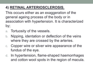 4) RETINAL ARTERIOSCLEROSIS.
This occurs either as an exaggeration of the
general ageing process of the body or in
association with hypertension. It is characterized
by;
a. Tortuosity of the vessels.
b. Nipping, identation or deflection of the veins
where they are crossed by the arteries.
c. Copper wire or silver wire appearance of the
fundus of the eye.
d. In hypertension, flame-shaped haemorrhages
and cotton wool spots in the region of macula.
 