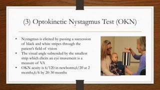 (3) Optokinetic Nystagmus Test (OKN)
• Nystagmus is elicited by passing a succession
of black and white stripes through the
patient’s field of vision
• The visual angle subtended by the smallest
strip which elicits an eye movement is a
measure of VA
• OKN acuity is 6/120 in newborns,6/20 at 2
months,6/6 by 20-30 months
 