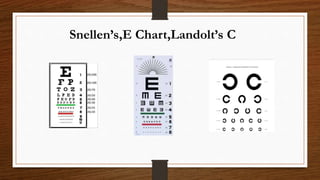 Snellen’s,E Chart,Landolt’s C
 