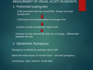 Visual Child Not First Visual aquity and contrast sensitivity | PPTX