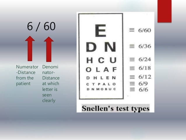 chart eye 6/6 test Visual sensitivity and contrast aquity
