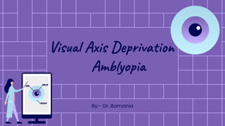Visual Axis Deprivation
Amblyopia
By:- Dr. Bamania
 