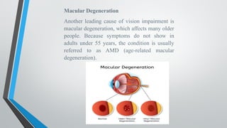 Macular Degeneration
Another leading cause of vision impairment is
macular degeneration, which affects many older
people. Because symptoms do not show in
adults under 55 years, the condition is usually
referred to as AMD (age-related macular
degeneration).
 