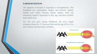 FARSIGHTEDNESS
The opposite of myopia is hyperopia or farsightedness. The
farsighted eye concentrates images and pictures slightly
behind your retina, blurring nearby objects. Kids can
sometimes outgrow hyperopia as they age, and their eyeballs
reach adult sizes.
Yes, the eyes grow during childhood– the eye’s length
elongates almost by 1/3 between birth and the age of five. It is
also common among family members.
 