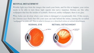 RETINAL DETACHMENT
•Visible light rays form the images that reach your brain, and for this to happen, your retina
needs to be able to turn those light signals into nerve impulses. Retinas are like silky
wallpapers that line the insides of eyeballs. However, unlike wallpaper, there is no glue.
•Tiny holes can develop where your retina is damaged or exceptionally thin. If this occurs,
the vitreous (eye fluid) that fills your eyes can leak behind the retina, causing the so-called
‘wallpaper’ to slide off. This is what is known as a detached retina or retinal detachment.
 