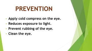 PREVENTION
• Apply cold compress on the eye.
• Reduces exposure to light.
• Prevent rubbing of the eye.
• Clean the eye.
 