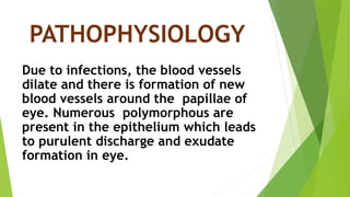 PATHOPHYSIOLOGY
Due to infections, the blood vessels
dilate and there is formation of new
blood vessels around the papillae of
eye. Numerous polymorphous are
present in the epithelium which leads
to purulent discharge and exudate
formation in eye.
 